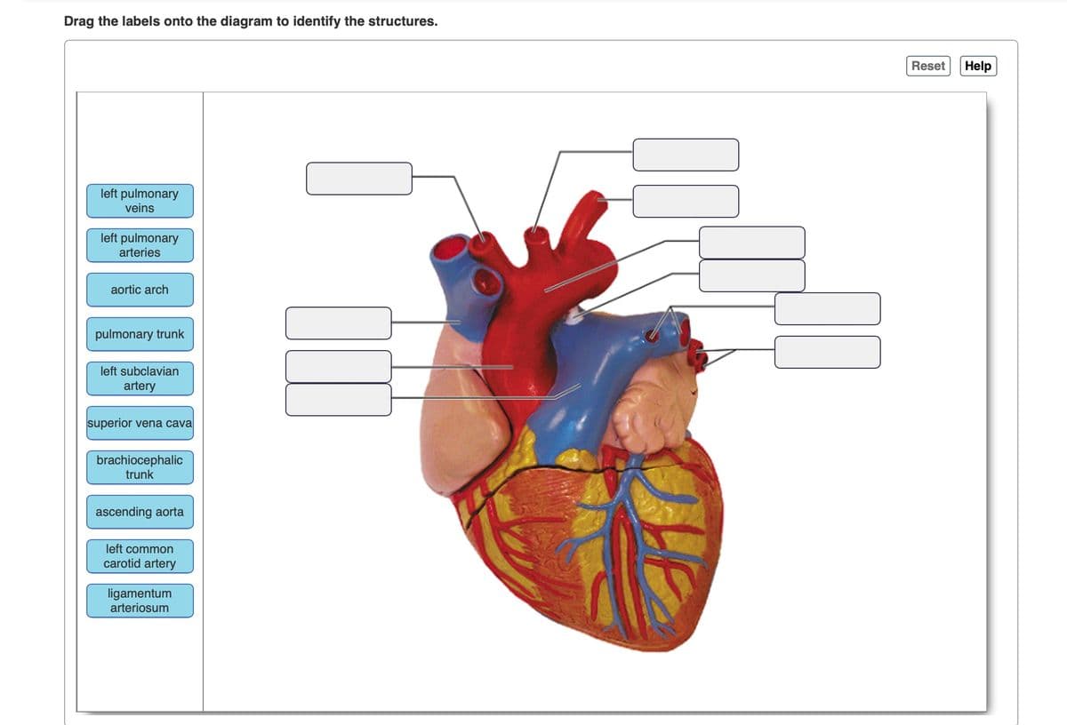 Drag the labels onto the diagram to identify the structures.
left pulmonary
veins
left puln
arteries
aortic arch
pulmonary trunk
left subclavian
artery
superior vena cava
brachiocephalic
trunk
ascending aorta
left common
carotid artery
ligamentum
arteriosum
11
10
Reset Help