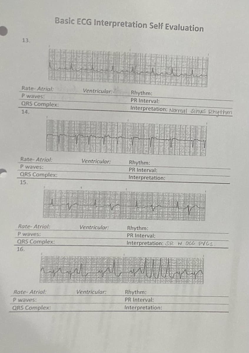 13.
Rate-Atrial:
P waves:
QRS Complex:
14.
Rate-Atrial:
P waves:
Basic ECG Interpretation Self Evaluation
QRS Complex:
15.
Rate-Atrial:
P waves:
QRS Complex:
16.
Rate-Atrial:
P waves:
QRS Complex:
Ventricular:
Ventricular:
Ventricular:
Ventricular:
Rhythm:
PR Interval:
Interpretation: Normal Sinus Rhythm
Rhythm:
PR Interval:
Interpretation:
Rhythm:
PR Interval:
Interpretation: SR W DCC PVCS
Rhythm:
PR Interval:
Interpretation: