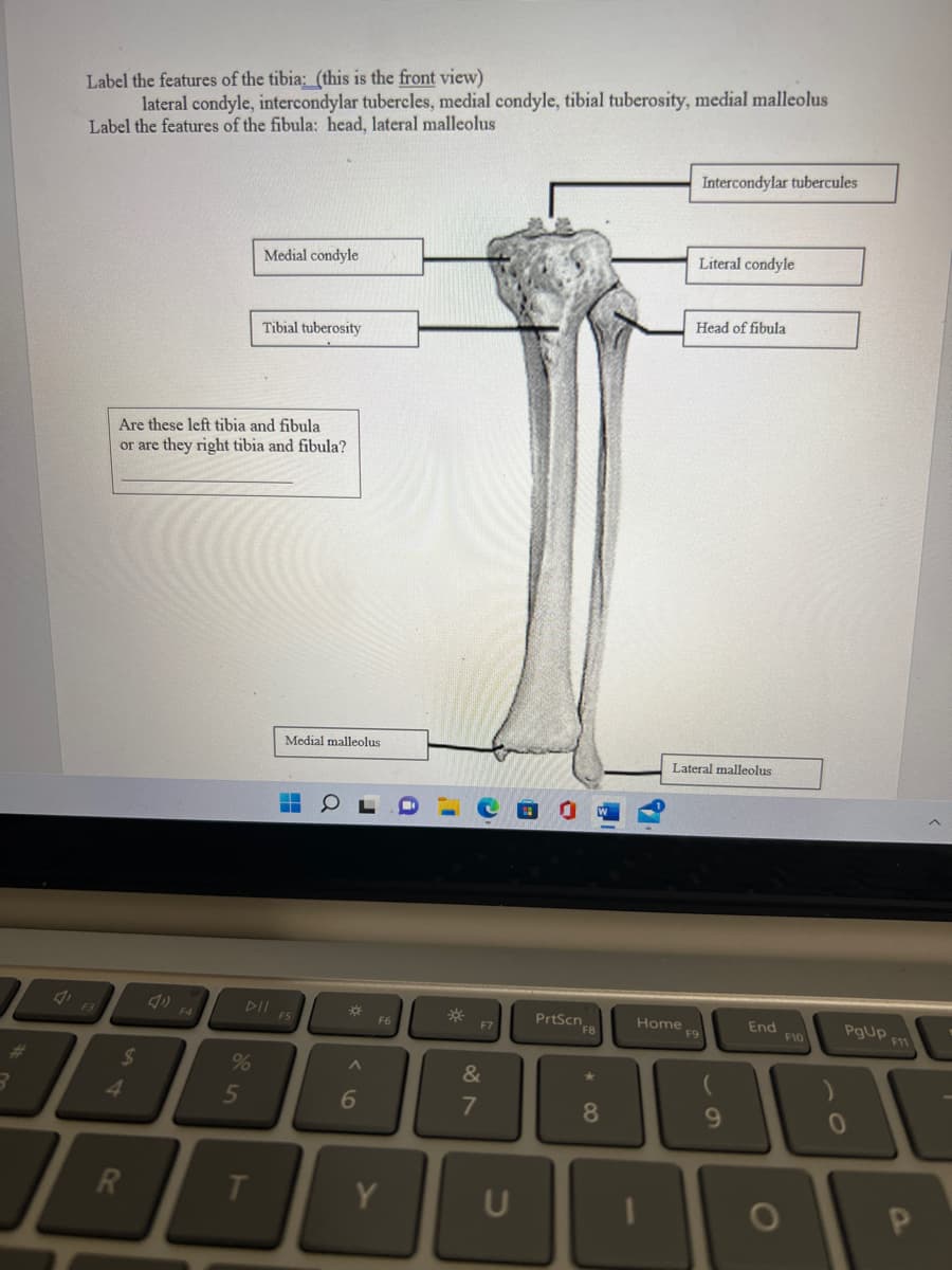 3
Label the features of the tibia: (this is the front view)
lateral condyle, intercondylar tubercles, medial condyle, tibial tuberosity, medial malleolus
Label the features of the fibula: head, lateral malleolus
$
Are these left tibia and fibula
or are they right tibia and fibula?
R
%
5
Medial condyle
T
Tibial tuberosity
Medial malleolus
‒‒
F5
*
A
6
F6
Y
*
F7
&
7
U
PrtScn
F8
*80
Home
Intercondylar tubercules
Literal condyle
Head of fibula
Lateral malleolus
F9
9
End
F10
O
PgUp F11
0
P