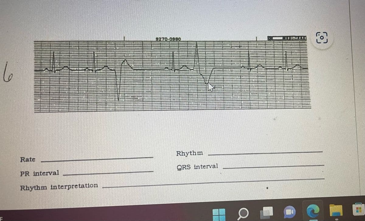 6
F
Rate
PR interval
Rhythm interpretation
9270-0980
Rhythm
QRS interval
10
TRIDELTH
O
HAIR BOURG