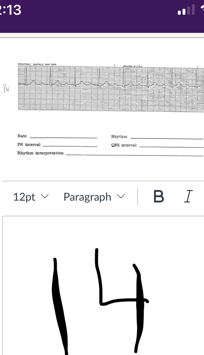 2:13
16
IPORATION BUFFALO NEW YORK
Rate
PR interval
Rhythm interpretation
12pt
Paragraph
Rhythm
QRS interval
D
B I