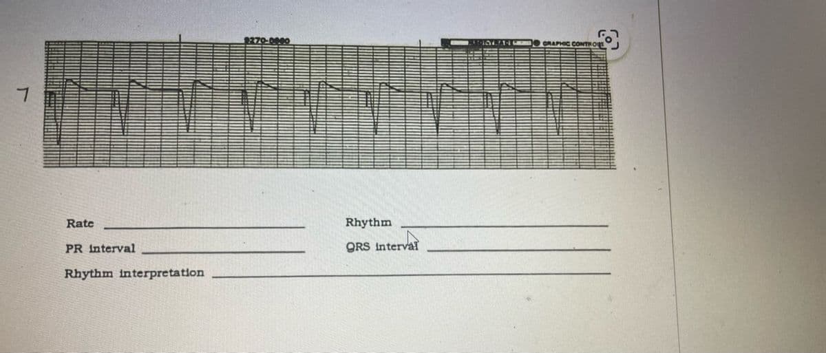 ។
Rate
PR interval
Rhythm interpretation
8270-0990
Rhythm
QRS interval
AUTOSTRA-IG GRAPHIC CONTROUS