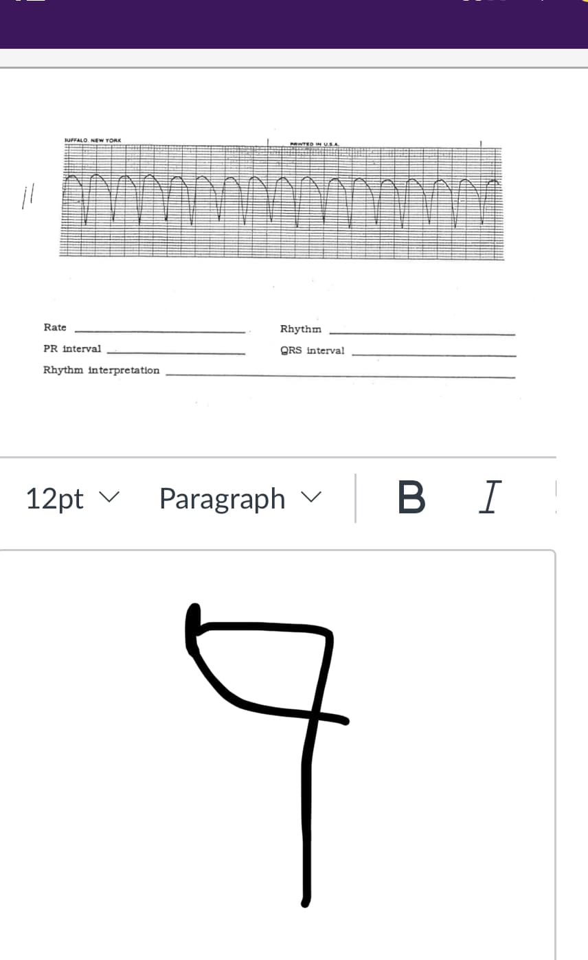 11
BUFFALO, NEW YORK
Rate
PR interval
Rhythm interpretation
12pt ✓
Rhythm
QRS interval
Paragraph
D
BI