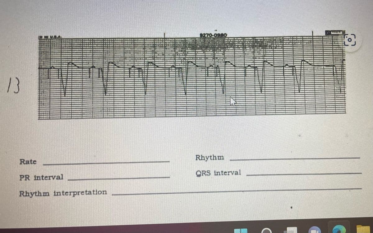 13
Rate
113.SA
PR interval
Rhythm interpretation
9270-0980
Rhythm
QRS interval
с
O