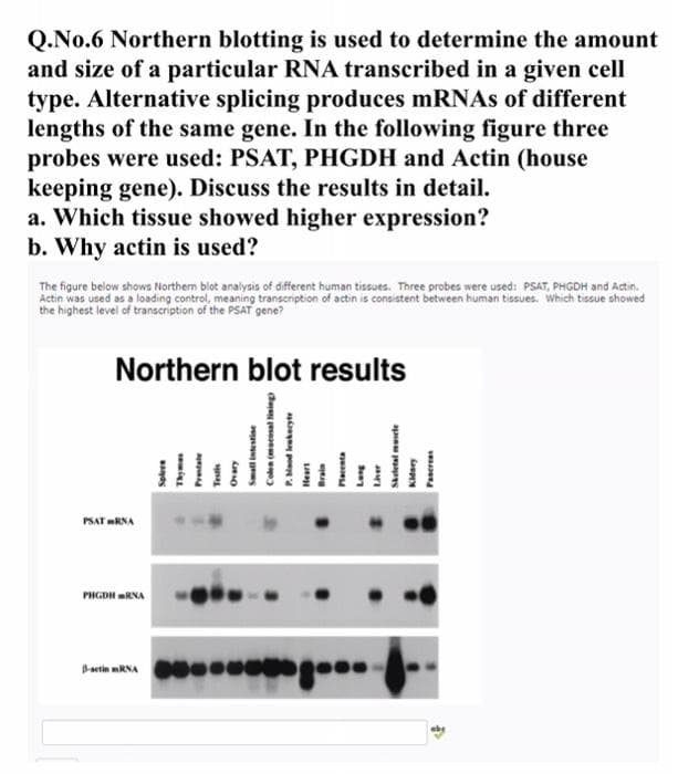 Q.No.6 Northern blotting is used to determine the amount
and size of a particular RNA transcribed in a given cell
type. Alternative splicing produces mRNAs of different
lengths of the same gene. In the following figure three
probes were used: PSAT, PHGDH and Actin (house
keeping gene). Discuss the results in detail.
a. Which tissue showed higher expression?
b. Why actin is used?
The figure below shows Northern blot analysis of different human tissues. Three probes were used: PSAT, PHGDH and Actin.
Actin was used as a loading control, meaning transcription of actin is consistent between human tissues. Which tissue showed
the highest level of transcription of the PSAT gene?
Northern blot results
PSAT mRNA
PHGDH RNA
Bactin mRNA
a
d esen)
P. Neod kekeryte
Placenta
Skeletal mele
