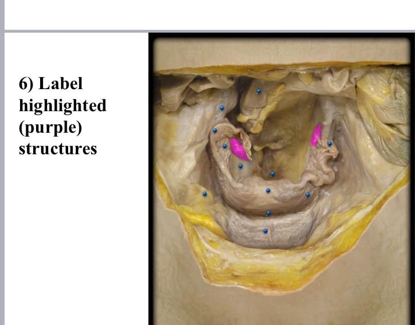 6) Label
highlighted
(purple)
structures