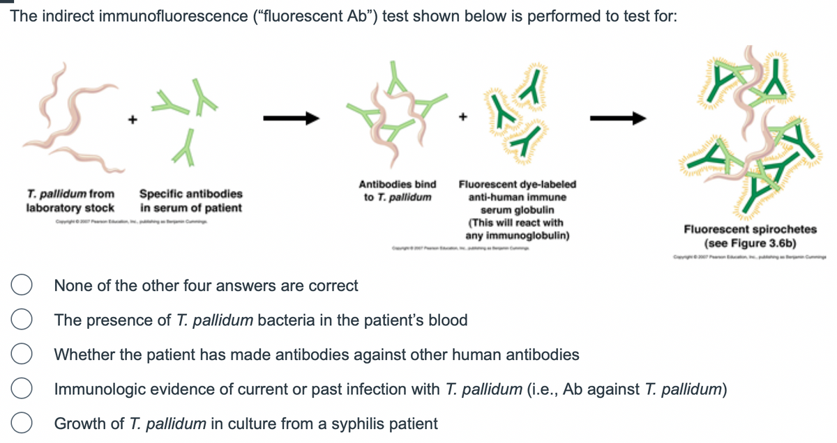 The indirect immunofluorescence ("fluorescent Ab") test shown below is performed to test for:
+
AA
T. pallidum from Specific antibodies
laboratory stock in serum of patient
Antibodies bind
to T. pallidum
+
ㅅ
Fluorescent dye-labeled
anti-human immune
serum globulin
(This will react with
any immunoglobulin)
Da
Fluorescent spirochetes
(see Figure 3.6b)
None of the other four answers are correct
The presence of T. pallidum bacteria in the patient's blood
Whether the patient has made antibodies against other human antibodies
Immunologic evidence of current or past infection with T. pallidum (i.e., Ab against T. pallidum)
Growth of T. pallidum in culture from a syphilis patient