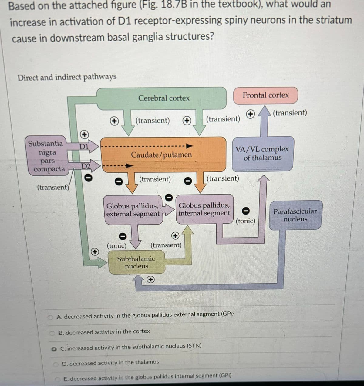 Based on the attached figure (Fig. 18.7B in the textbook), what would an
increase in activation of D1 receptor-expressing spiny neurons in the striatum
cause in downstream basal ganglia structures?
Direct and indirect pathways
Substantia
D1
nigra
pars
D2
compacta
(transient)
Frontal cortex
Cerebral cortex
(transient)
+
(transient) +
(transient)
Caudate/putamen
VA/VL complex
of thalamus
(transient)
(transient)
Globus pallidus,
Globus pallidus,
external segment
internal segment
0
(tonic)
(tonic)
+
(transient)
Subthalamic
nucleus
OA. decreased activity in the globus pallidus external segment (GPe
B. decreased activity in the cortex
C. increased activity in the subthalamic nucleus (STN)
D. decreased activity in the thalamus
E. decreased activity in the globus pallidus internal segment (GPI)
Parafascicular
nucleus