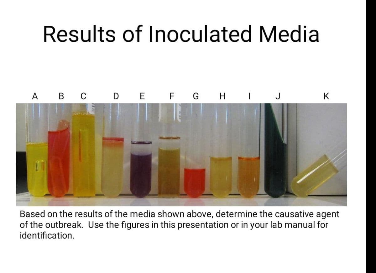 Results of Inoculated Media
A B C D E F G H I J
K
Based on the results of the media shown above, determine the causative agent
of the outbreak. Use the figures in this presentation or in your lab manual for
identification.