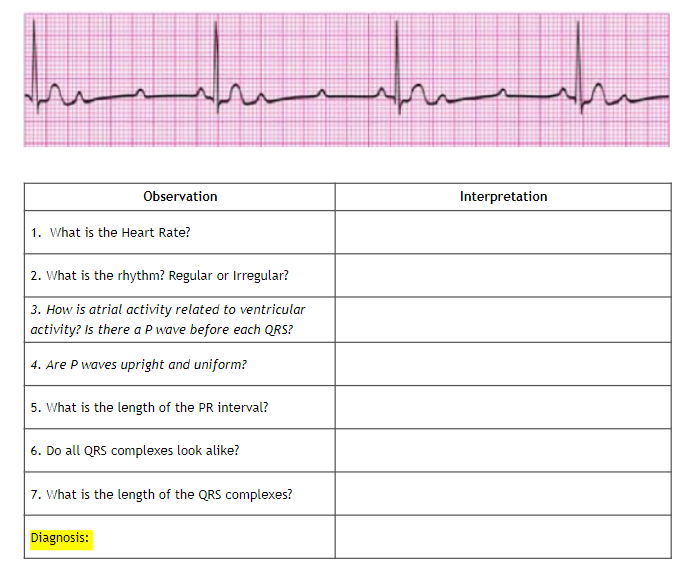 Observation
1. What is the Heart Rate?
2. What is the rhythm? Regular or Irregular?
3. How is atrial activity related to ventricular
activity? Is there a P wave before each QRS?
4. Are P waves upright and uniform?
5. What is the length of the PR interval?
6. Do all QRS complexes look alike?
7. What is the length of the QRS complexes?
Diagnosis:
سرسید
Interpretation