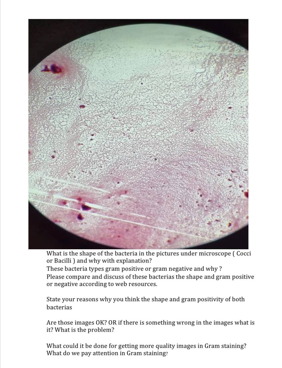 What is the shape of the bacteria in the pictures under microscope ( Cocci
or Bacilli ) and why with explanation?
These bacteria types gram positive or gram negative and why ?
Please compare and discuss of these bacterias the shape and gram positive
or negative according to web resources.
State your reasons why you think the shape and gram positivity of both
bacterias
Are those images OK? OR if there is something wrong in the images what is
it? What is the problem?
What could it be done for getting more quality images in Gram staining?
What do we pay attention in Gram staining?
