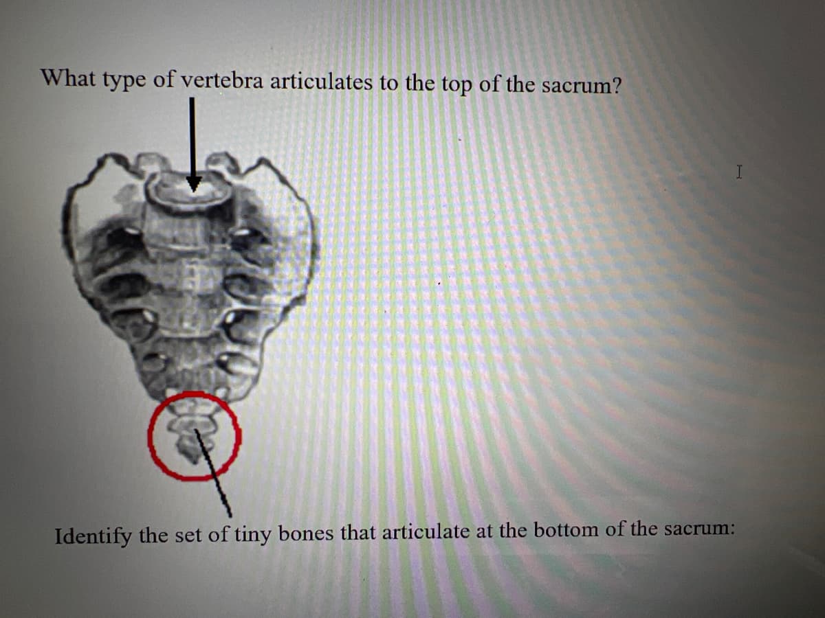 What type of vertebra articulates to the top of the sacrum?
Identify the set of tiny bones that articulate at the bottom of the sacrum:
I
