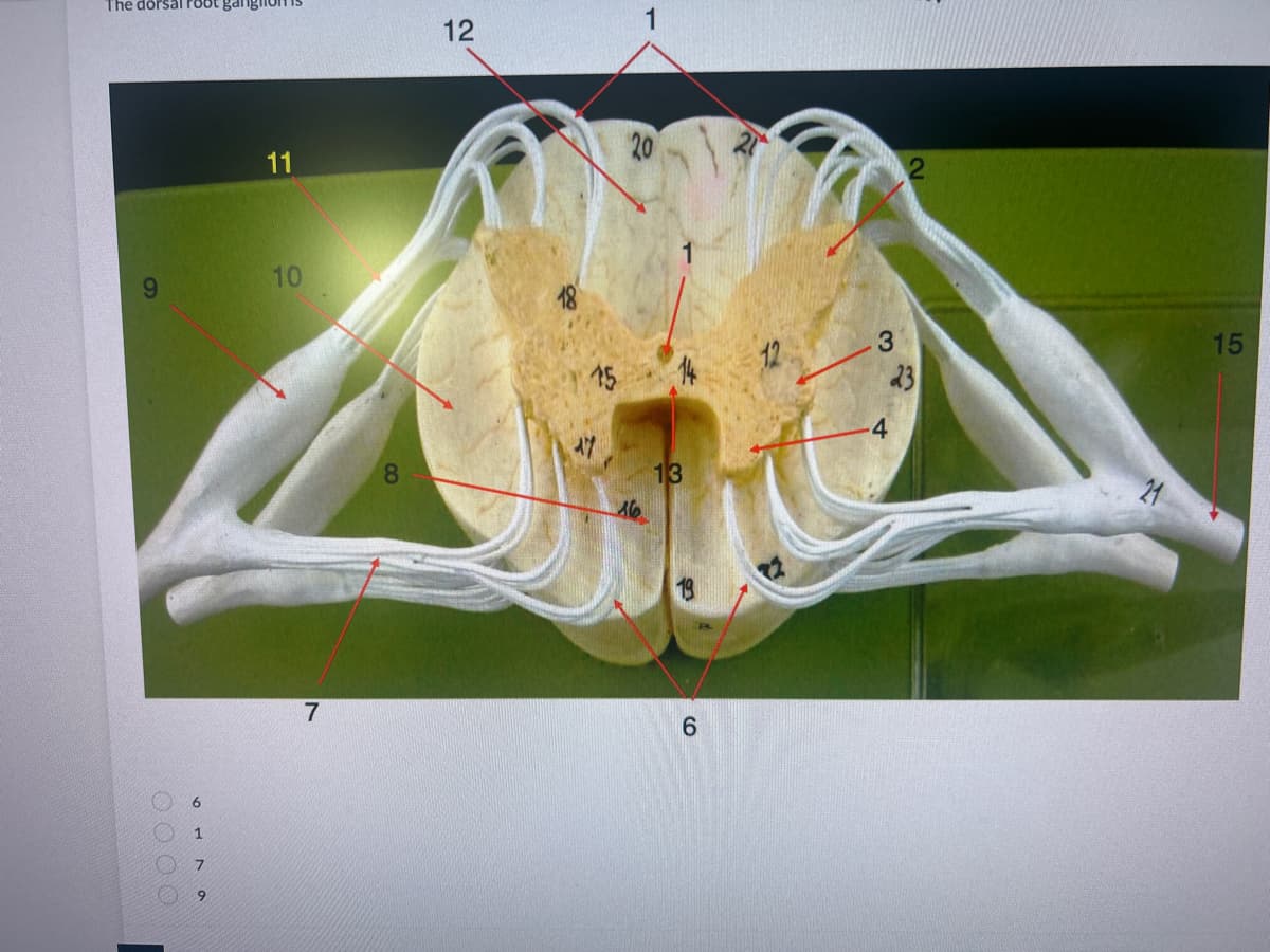 The dorsal root gangin
614a
7
11
10
7
8
12
21
15
AY
20
13
6
3
4
23
21
15