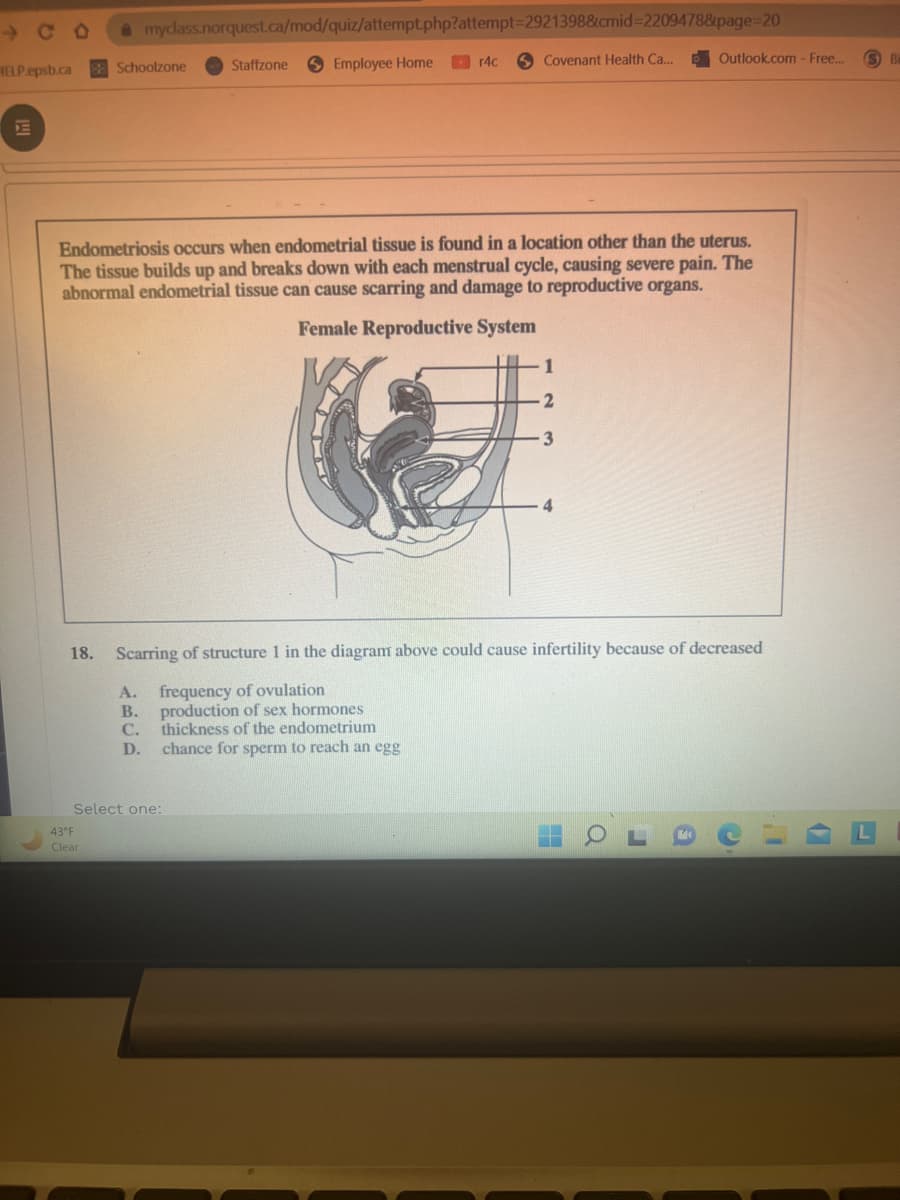 HELP.epsb.ca
myclass.norquest.ca/mod/quiz/attempt.php?attempt=2921398&cmid=2209478&page=20
Schoolzone
43 F
Clear
Staffzone
Employee Home
Select one:
r4c
Endometriosis occurs when endometrial tissue is found in a location other than the uterus.
The tissue builds up and breaks down with each menstrual cycle, causing severe pain. The
abnormal endometrial tissue can cause scarring and damage to reproductive organs.
Female Reproductive System
production of sex hormones
thickness of the endometrium
chance for sperm to reach an egg
Covenant Health Ca...
1
18. Scarring of structure 1 in the diagram above could cause infertility because of decreased
A. frequency of ovulation
B.
C.
D.
Outlook.com - Free...
3
1)
S Ba