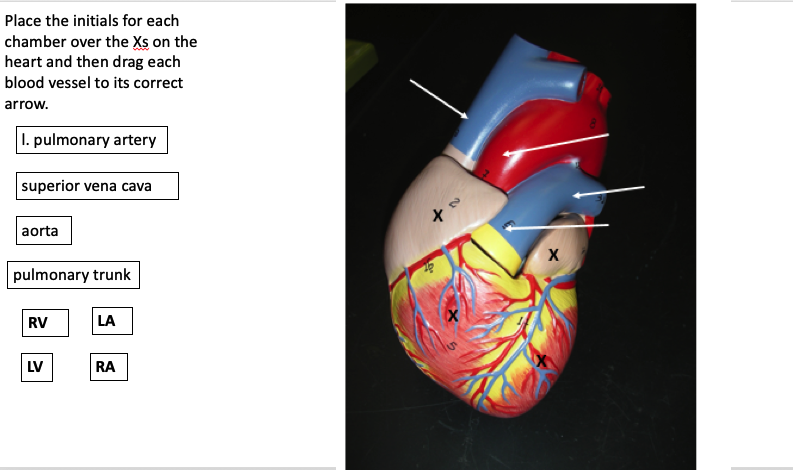 Place the initials for each
chamber over the Xs on the
heart and then drag each
blood vessel to its correct
arrow.
I. pulmonary artery
superior vena cava
aorta
pulmonary trunk
RV
LA
LV
RA
