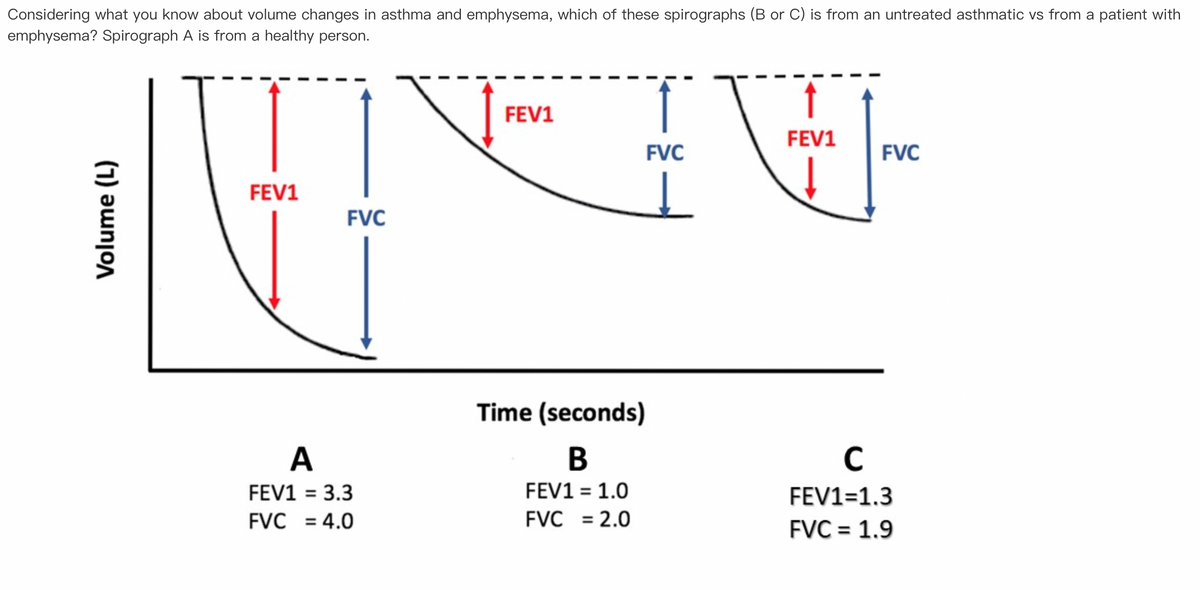 Considering what you know about volume changes in asthma and emphysema, which of these spirographs (B or C) is from an untreated asthmatic vs from a patient with
emphysema? Spirograph A is from a healthy person.
Volume (L)
FEV1
FVC
A
FEV1 = 3.3
FVC = 4.0
FEV1
Time (seconds)
B
FEV1 = 1.0
FVC = 2.0
FVC
Į
V
FEV1
FVC
с
FEV1=1.3
FVC = 1.9