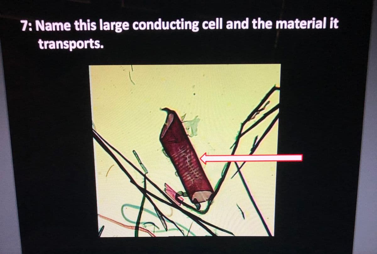 7: Name this large conducting cell and the material it
transports.
