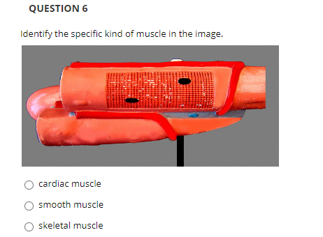 QUESTION 6
Identify the specific kind of muscle in the image.
cardiac muscle
smooth muscle
O skeletal muscle
