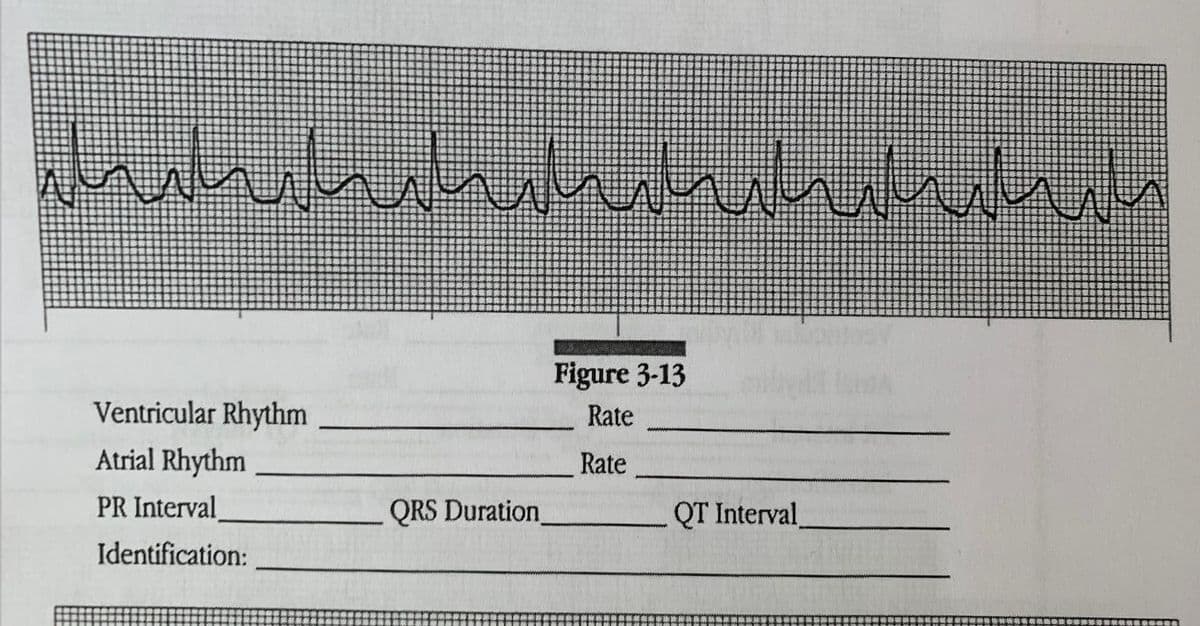 سلیمان ان الله من حل حالت
Ventricular Rhythm
Atrial Rhythm
PR Interval
Identification:
QRS Duration
Figure 3-13
Rate
Rate
QT Interval