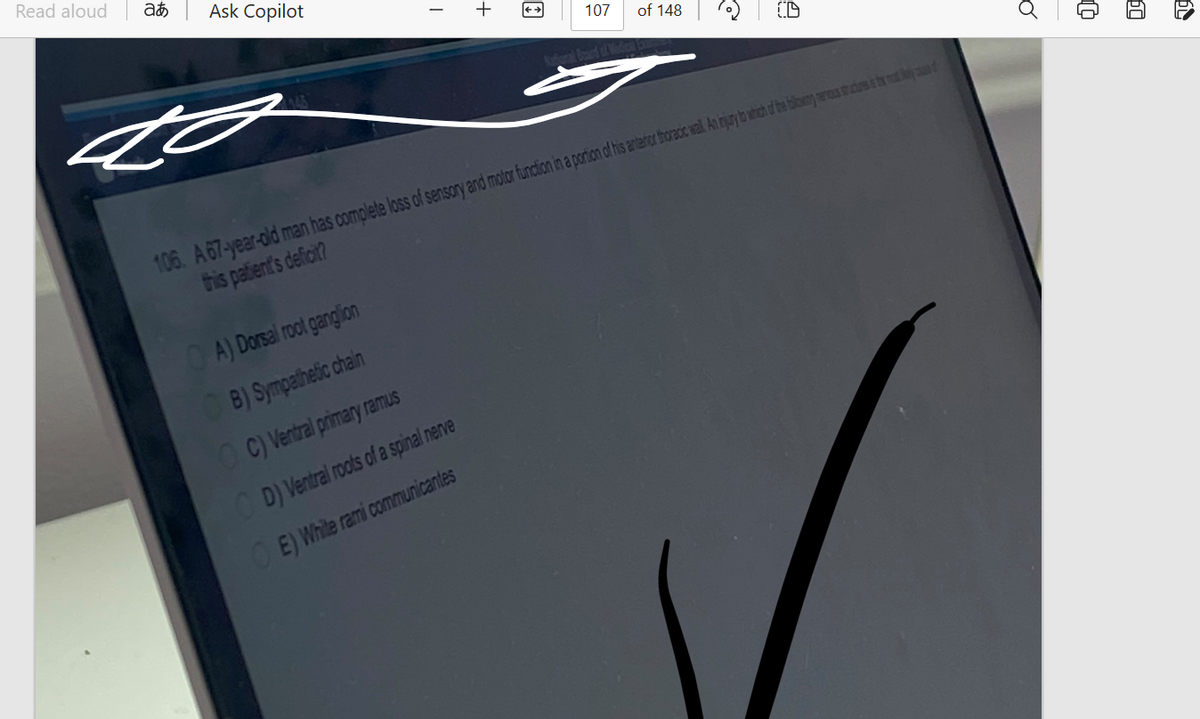 Read aloud
at
Ask Copilot
مع
I
A) Dorsal root ganglion
B) Sympathetic chain
+
OC) Ventral primary ramus
OD) Ventral roots of a spinal nerve
OE) White rami communicantes
107
9
106. A 67-year-old man has complete loss of sensory and motor function in a portion of his anterior thoracic wall An injury to which of the blowing nervous to custo d
this patient's deficit?
of 148
o
t
60