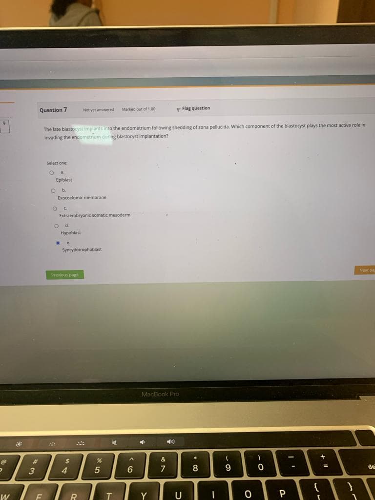 9
P
W
عليكم
3
Question 7
F
Select one:
O a.
The late blastocyst implants into the endometrium following shedding of zona pellucida. Which component of the blastocyst plays the most active role in
invading the endometrium during blastocyst implantation?
O
Epiblast
b.
Exocoelomic membrane.
O
C.
Hypoblast
Extraembryonic somatic mesoderm
O d.
D e.
Not yet answered
Syncytiotrophoblast
Previous page
54
R
%
55
Marked out of 1.00
*
T
^
6
MacBook Pro
4
Y
P Flag question
&
7
4)
U
8
-
(
9
O
)
.O
3
-
P
{
+ 11
=
1
Next pag
de