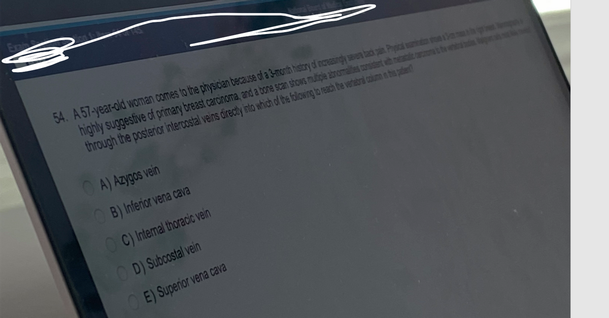 Exa
54. A 57-year-old woman comes to the physician because of a 3-month history of increasingly severe back pain. Physical amination to S
highly suggestive of primary breast carcinome, and a bone scan shows multiple abnormalities consistent with metastatic come to the tradi
through the posterior intercostal veins directly into which of the following to reach the vertebral column in this patient?
A) Azygos vein
B) Inferior vena cava
OC) Internal thoracic vein
OD) Subcostal vein
OE) Superior vena cava