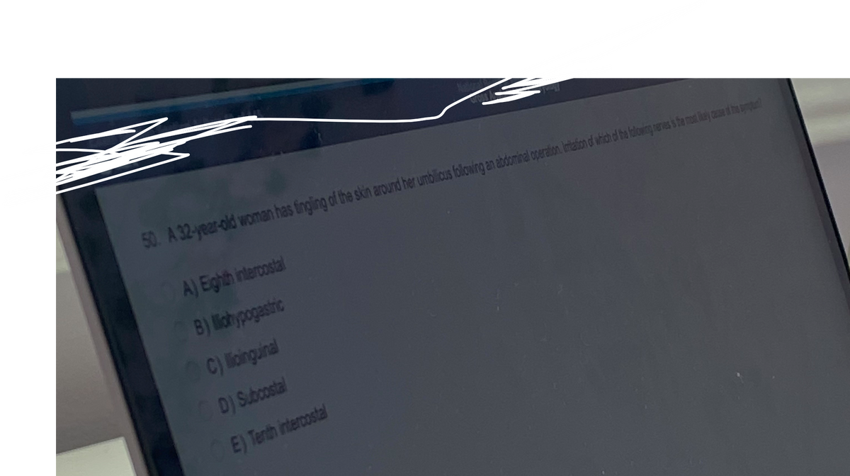 z
50. A 32-year-old woman has fingling of the skin around her umbilicus following an abdominal operation. Initiation of which of the following nerves is the most hay cause of the prop
A) Eighth intercostal
B) lohypogastric
C) lioinguinal
D) Subcostal
E) Tenth intercostal