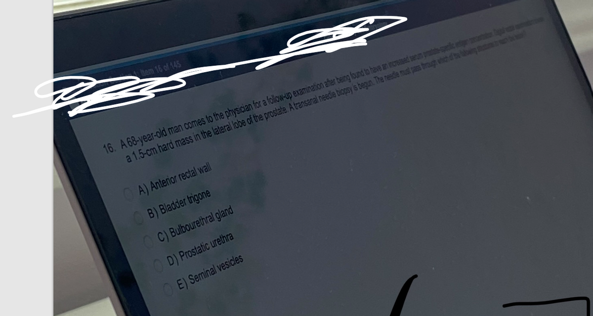 4 tem 16 of 145
2233
S
16. A 68-year-old man comes to the physician for a follow-up examination after being found to have an increased serum prostate-specifice
a 1.5-cm hard mass in the lateral lobe of the prostate. A transanal needle biopsy is begun. The needle must pass through which of the big
A) Anterior rectal wall
B) Bladder trigone
OC) Bulbourethral gland
OD) Prostatic urethra
E) Seminal vesicles