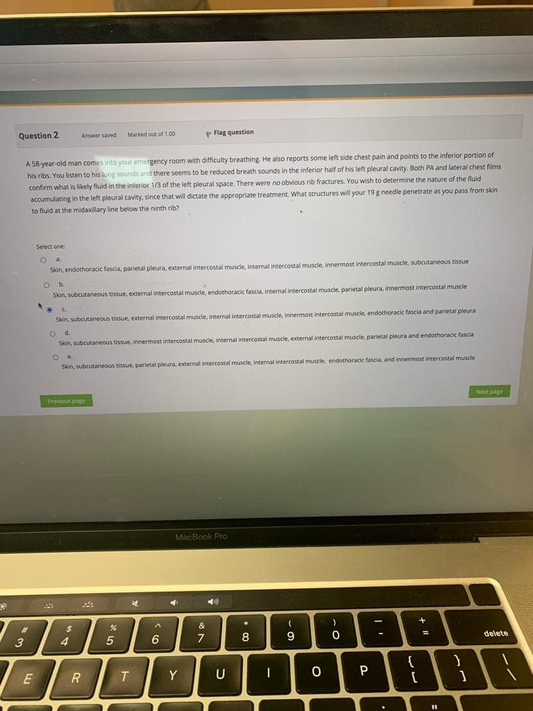 Question 2
سلام
3
A 58-year-old man comes into your emergency room with difficulty breathing. He also reports some left side chest pain and points to the inferior portion of
his ribs. You listen to his lung sounds and there seems to be reduced breath sounds in the inferior half of his left pleural cavity. Both PA and lateral chest films
confirm what is likely fluid in the inferior 1/3 of the left pleural space. There were no obvious rib fractures. You wish to determine the nature of the fluid
accumulating in the left pleural cavity, since that will dictate the appropriate treatment. What structures will your 19 g needle penetrate as you pass from skin
to fluid at the midaxillary line below the ninth rib?
E
Answer saved Marked out of 1.00
Select one:
O a.
Skin, endothoracic fascia, parietal pleura, external intercostal muscle, internal intercostal muscle, innermost intercostal muscle, subcutaneous tissue
O b.
4
Skin, subcutaneous tissue, external intercostal muscle, endothoracic fascia, internal intercostal muscle, parietal pleura, innermost intercostal muscle
20
C.
Skin, subcutaneous tissue, external intercostal muscle, internal intercostal muscle, innermost intercostal muscle, endothoracic fascia and parietal pleura
0 d.
Skin, subcutaneous tissue, innermost intercostal muscle, internal intercostal muscle, external intercostal muscle, parietal pleura and endothoracic fascia
O
e.
Skin, subcutaneous tissue, parietal pleura, external intercostal muscle, internal intercostal muscle, endothoracic fascia, and innermost intercostal muscle
Previous page
$
4
R
%
5
P Flag question
T
of
6
MacBook Pro
Y
&
7
(0)
U
* 00
8
-
(
9
O
)
0
P
{
+
[
11
}
1
Next page
delete