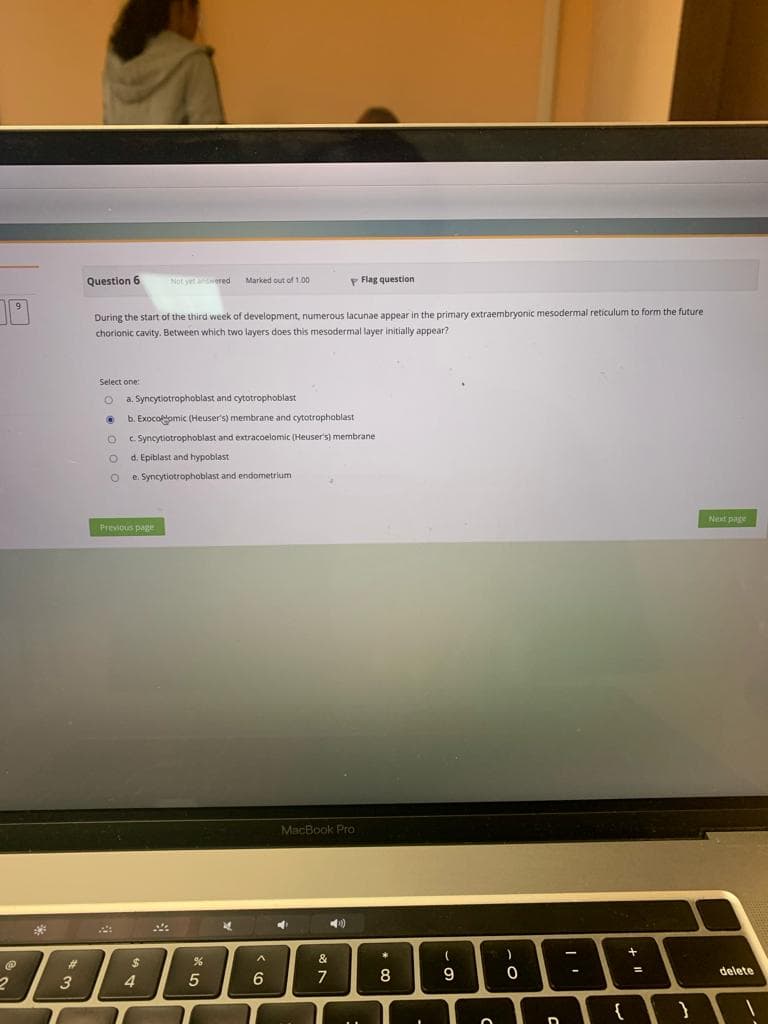 10
@
2
#
3
Question 6
During the start of the third week of development, numerous lacunae appear in the primary extraembryonic mesodermal reticulum to form the future
chorionic cavity. Between which two layers does this mesodermal layer initially appear?
Select one:
O a. Syncytiotrophoblast and cytotrophoblast
@
O
O
b. Exocolomic (Heuser's) membrane and cytotrophoblast.
c. Syncytiotrophoblast and extracoelomic (Heuser's) membrane
d. Epiblast and hypoblast
O e. Syncytiotrophoblast and endometrium
Previous page
Not yet answered
$
4
24
Marked out of 1,00
%
5
4
A
6
P Flag question
MacBook Pro
<44)
&
7
*
x
8
(
9
c
-0
D
-
{
+ 11
}
Next page
delete