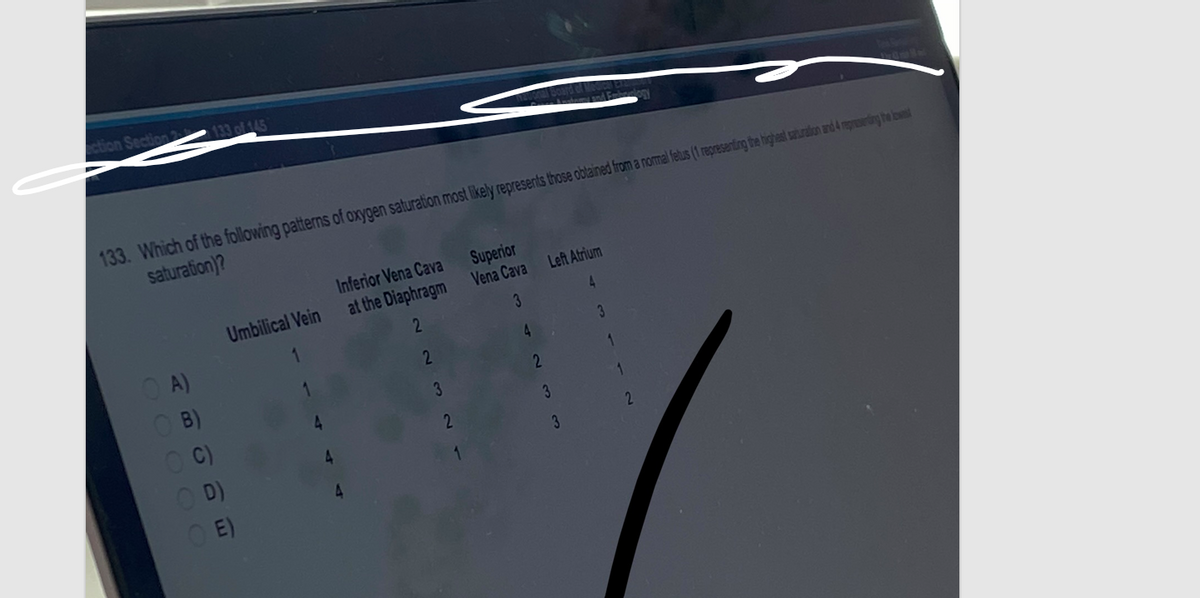 ection Section 2
133 of 145
133. Which of the following patterns of oxygen saturation most likely represents those obtained from a normal fetus (1 representing the highest saturation and 4 representing the lowest
saturation)?
A)
OB)
OC)
OD)
OE)
Umbilical Vein
1
Inferior Vena Cava
at the Diaphragm
2
2
3
Superior
Vena Cava
3
2
4
2
Left Atrium
4
3
3
3
2