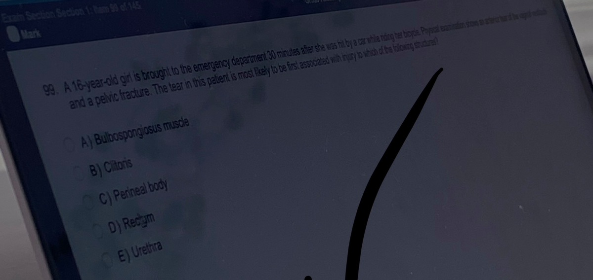 Exain Section Section 1: Ram 99 of 145
99. A 16-year-old girl is brought to the emergency department 30 minutes after she was hit by a car while nding her bicycle. Physical examination stoms an atte
and a pelvic fracture. The tear in this patient is most likely to be first associated with injury to which of the following structures?
A) Bulbospongiosus muscle
B) Clitoris
C) Perineal body
D) Recym
E) Urethra