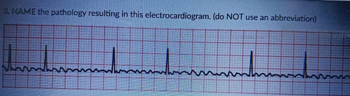 3. NAME the pathology resulting in this electrocardiogram. (do NOT use an abbreviation)
1
num