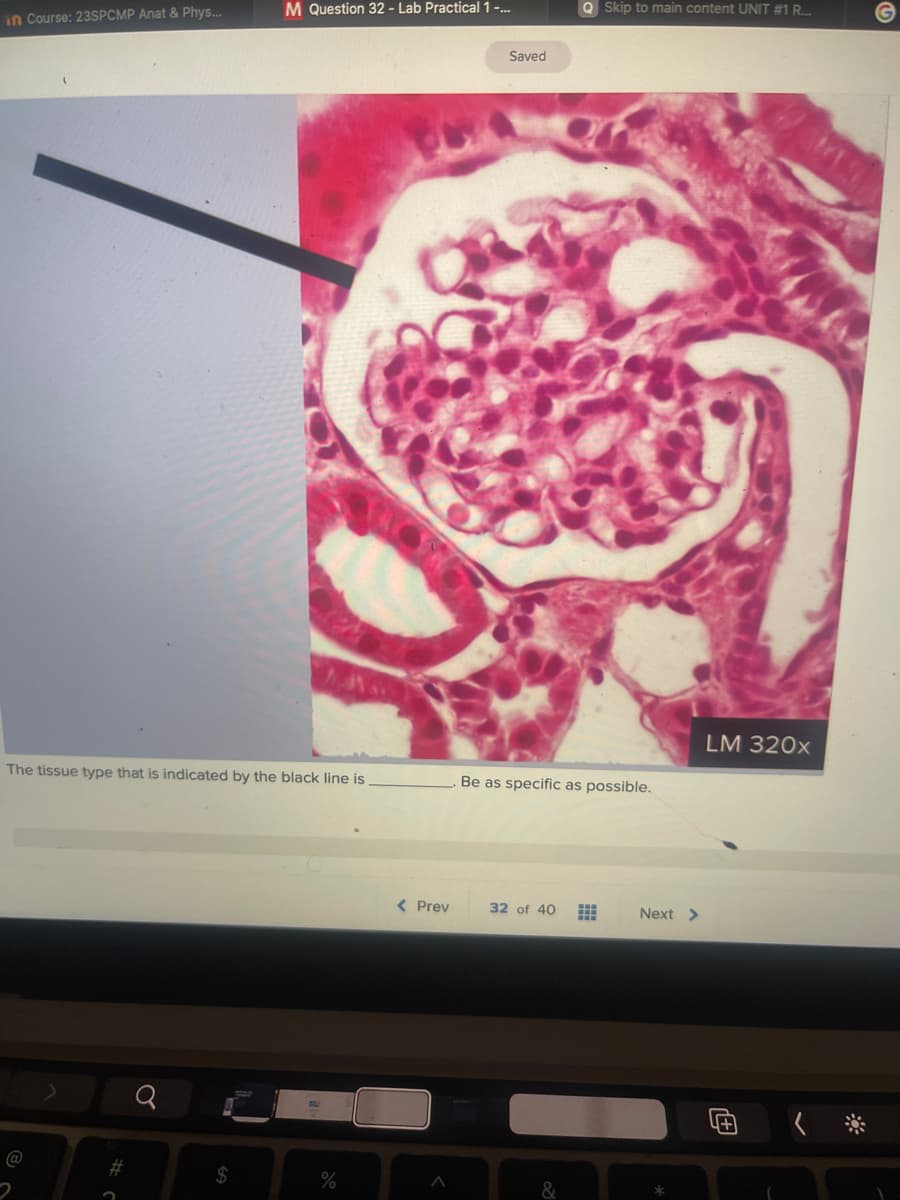 in Course: 23SPCMP Anat & Phys...
The tissue type that is indicated by the black line is
@
#
M Question 32 - Lab Practical 1 -...
$
%
< Prev
Saved
Q Skip to main content UNIT #1 R...
Be as specific as possible.
32 of 40
Next >
LM 320x
4+