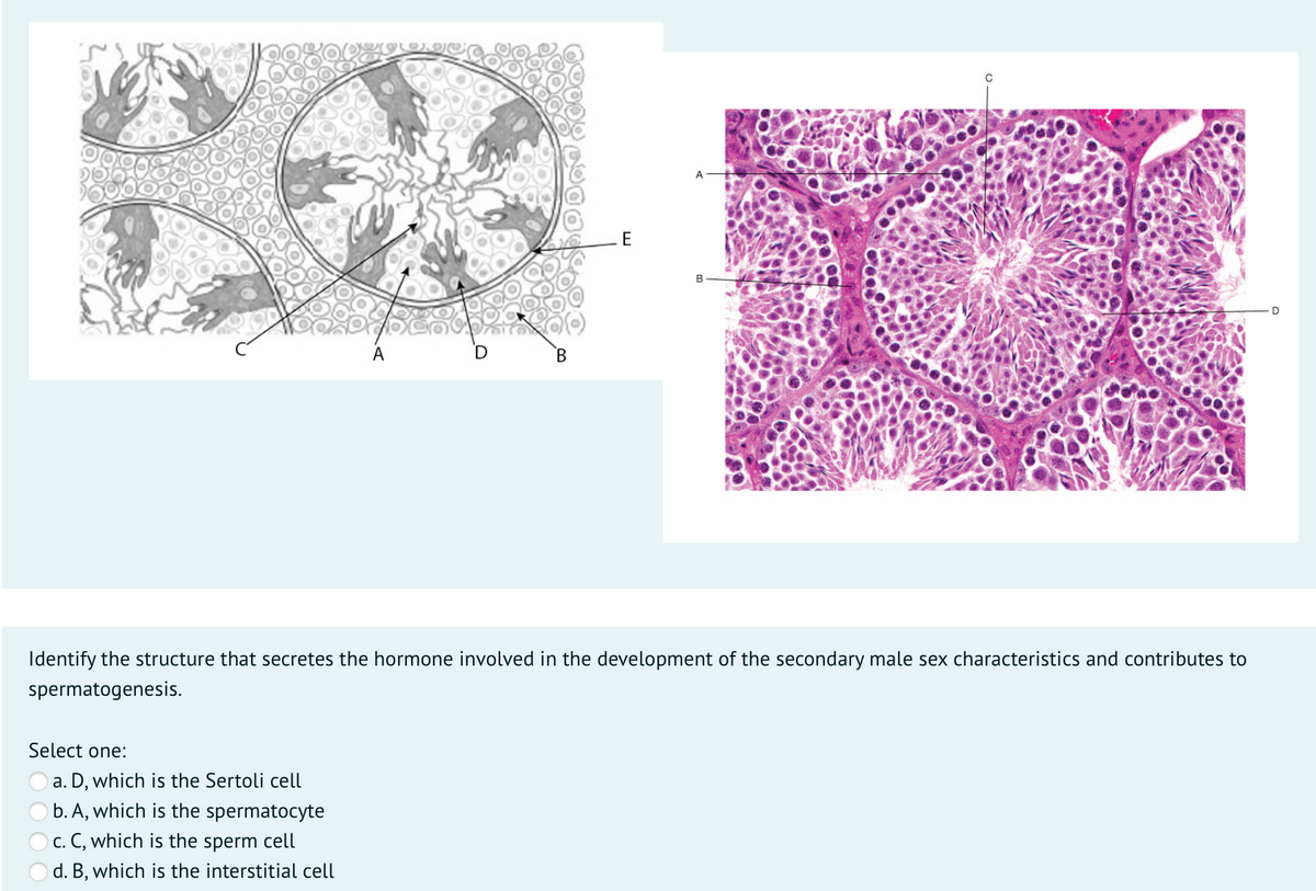 E
B
A
В
Identify the structure that secretes the hormone involved in the development of the secondary male sex characteristics and contributes to
spermatogenesis.
Select one:
a. D, which is the Sertoli cell
b. A, which is the spermatocyte
O c. C, which is the sperm cell
O d. B, which is the interstitial cell
