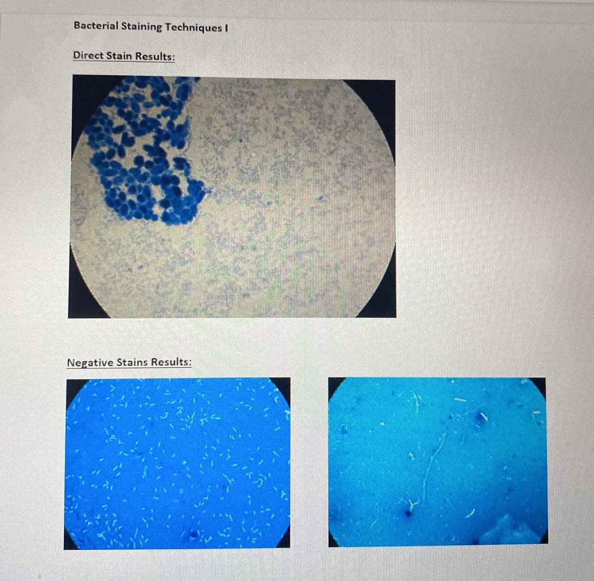 Bacterial Staining Techniques I
Direct Stain Results:
Negative Stains Results:
