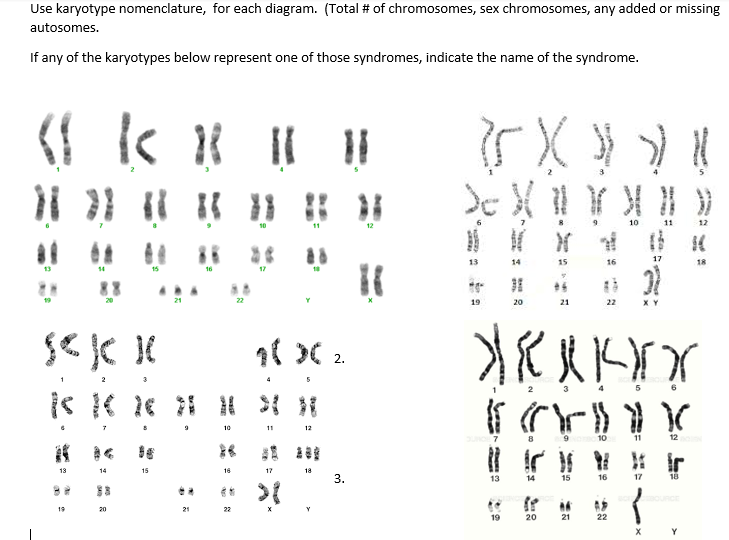 Use karyotype nomenclature, for each diagram. (Total # of chromosomes, sex chromosomes, any added or missing
autosomes.
If any of the karyotypes below represent one of those syndromes, indicate the name of the syndrome.
11
12
17
13
16
19
20
21
22
10
11
12
10
11
12
13
14
15
16
17
18
3.
13
14
15
16
17
18
ounce
19
20
21
22
19
20
21
22
Y
