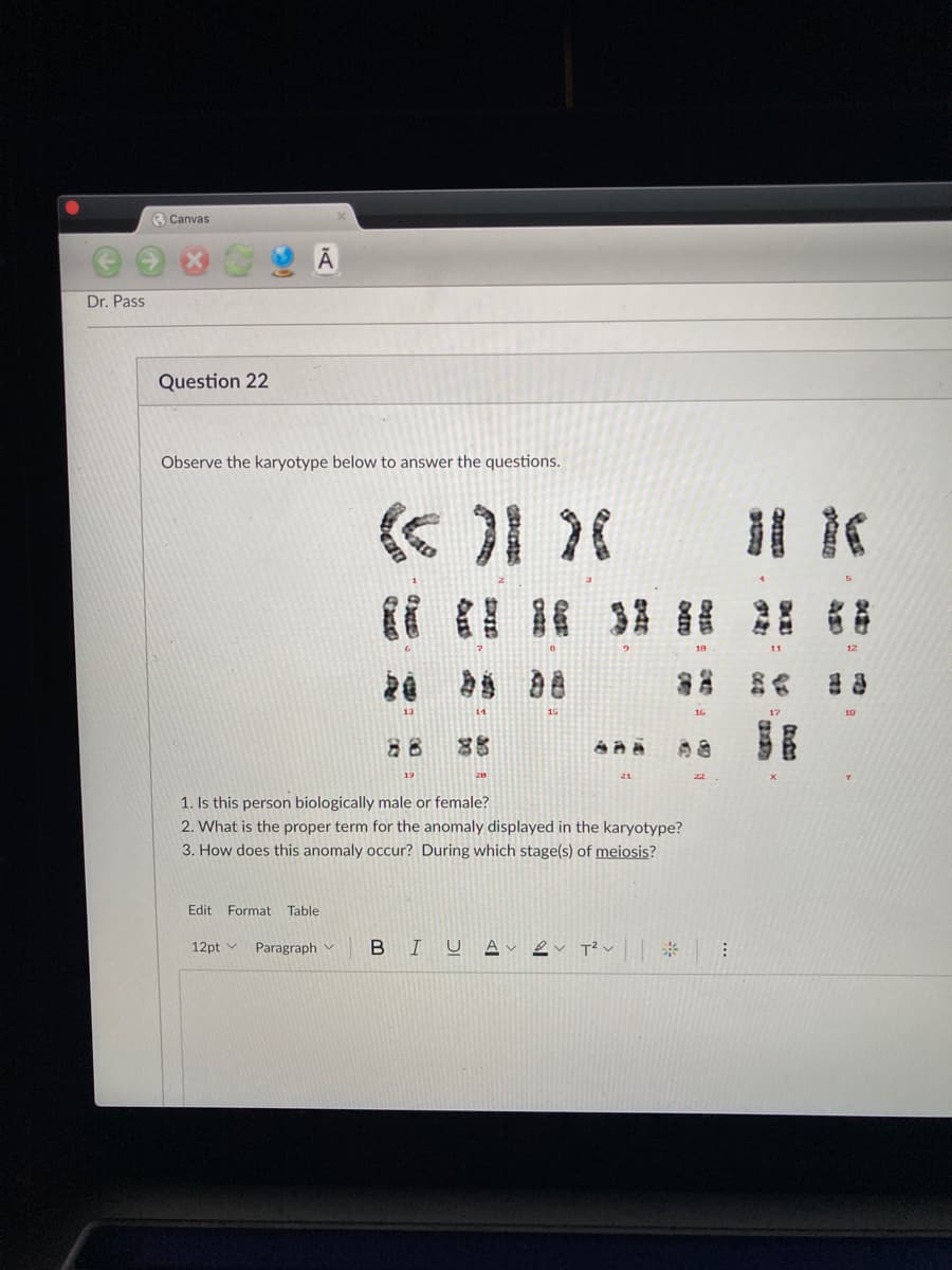 O Canvas
Dr. Pass
Question 22
Observe the karyotype below to answer the questions.
く)1 (
3 2 器
11
20
身S a8
16
10
88
85
21
1. Is this person biologically male or female?
2. What is the proper term for the anomaly displayed in the karyotype?
3. How does this anomaly occur? During which stage(s) of meiosis?
Edit Format Table
12pt v
Paragraph v
U A
