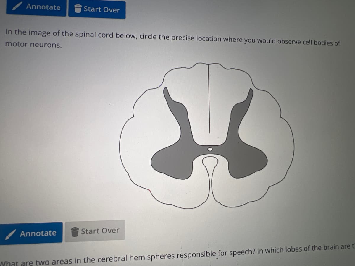 Annotate
Start Over
In the image of the spinal cord below, circle the precise location where you would observe cell bodies of
motor neurons.
Annotate
Start Over
What are two areas in the cerebral hemispheres responsible for speech? In which lobes of the brain are t