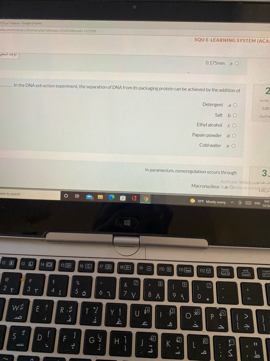 t (5 a 1 dao) - Google Chrome
edu.om/mod/quiz/attempt.php?attempt=2334320&cmid=1127808
SQU E-LEARNING SYSTEM (ACAI
الوقت المتبقي
0.175mm .e O
In the DNA extraction experiment, the separation of DNA from its packaging protein can be achieved by the addition of
Detergent aO
1.00
Salt b O
هذا السؤال
Ethyl alcohol cO
Papain powder
.d O
Cold water
Le O
In paramecium, osmoregulation occurs through
3
Activate Windowssk
Macronucleus Goaotings to acttivate do
nere to search
6.
70°F Mostly sunny
9:05
ENG
12/18
f2 O
f3 O
f4 O
f6 O
f8
end
f7 0
F10
insert
f9 D
F12 T
num IA
break
@
%24
&
8
2
3 r
4
5
6 7
8 A
9 9
R
Y !
U
S
F
G
J
K
+||
回 Q
以 4
