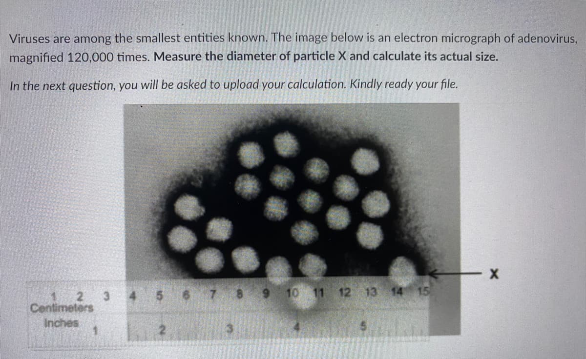 Viruses are among the smallest entities known. The image below is an electron micrograph of adenovirus,
magnified 120,000 times. Measure the diameter of particle X and calculate its actual size.
In the next question, you will be asked to upload your calculation. Kindly ready your file.
6 7 8 9
10 11
12 13 14
15
3.
Centimeters
Inches
