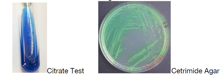 Citrate Test
|Cetrimide Agar
