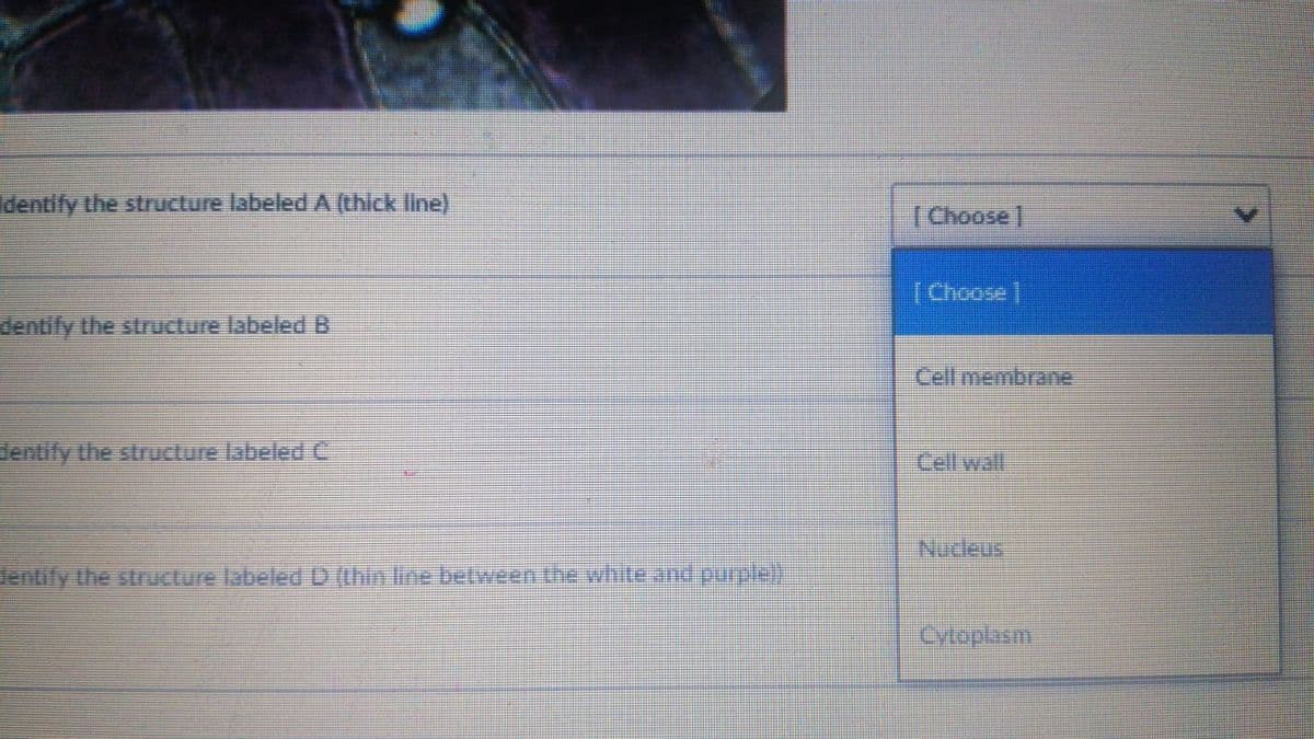 dentify the structure labeled A (thick line)
I Choose |
(Choose
dentify the structure labeledB
Cell membrane
dentify the structure labeledC
Cell wall
Nucleus
Jentify the structure labeled D (thin line belween the whiteeand purple)
yloplasm
