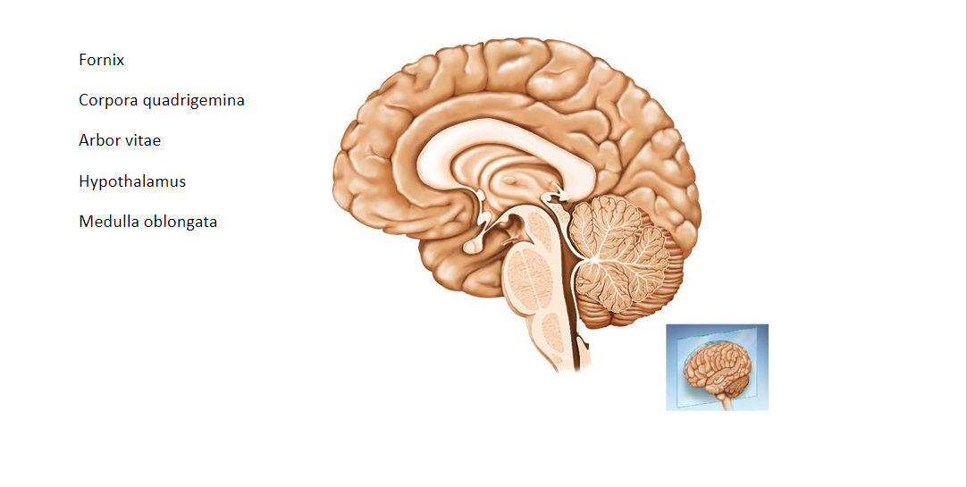 Fornix
Corpora quadrigemina
Arbor vitae
Hypothalamus
Medulla oblongata