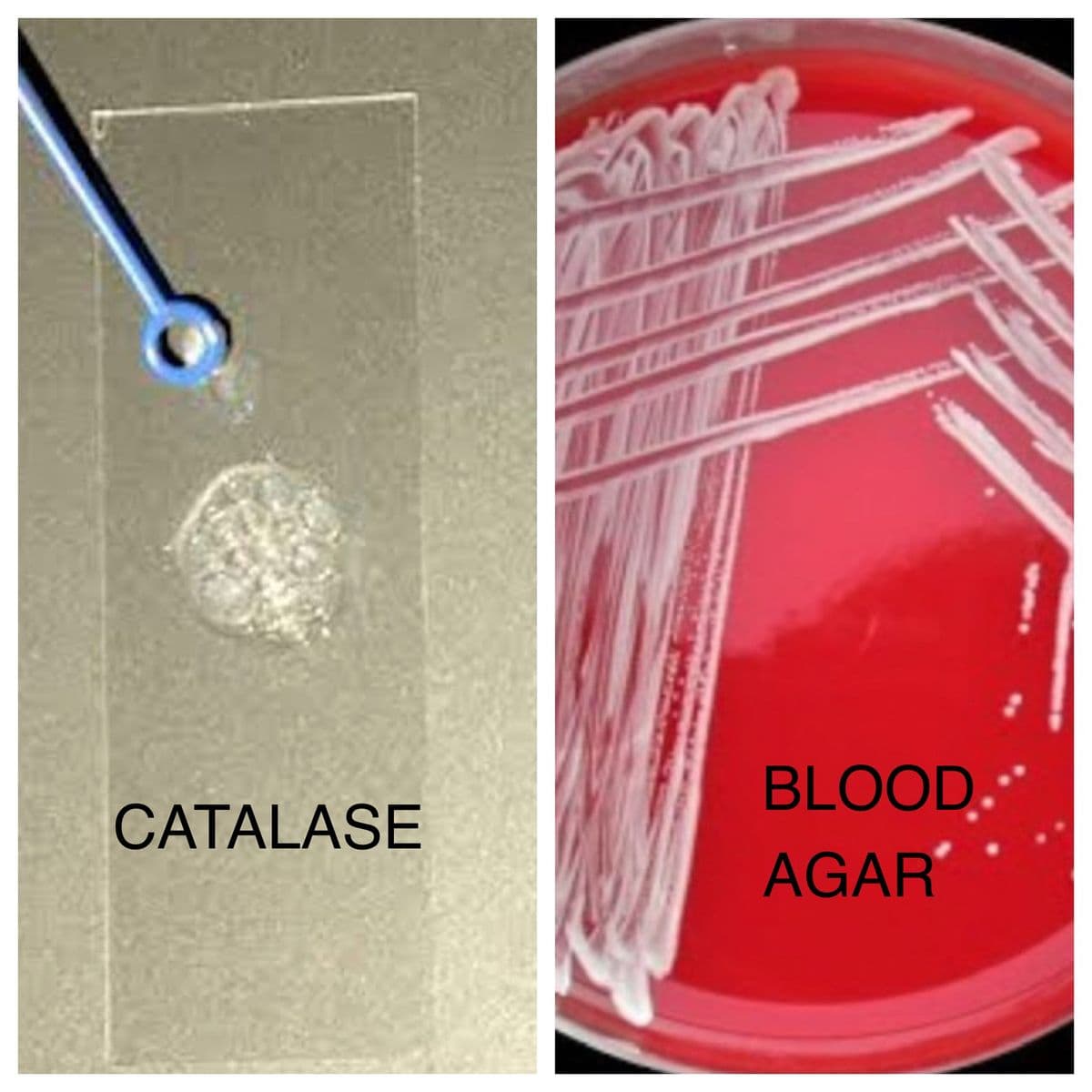 BLOOD.
CATALASE
AGAR
