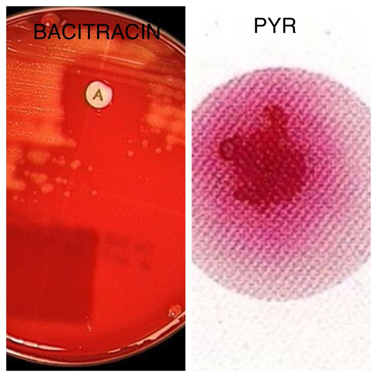 BACITRACIN
PYR
