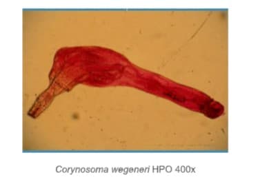 Corynosoma wegeneri HPO 400x
