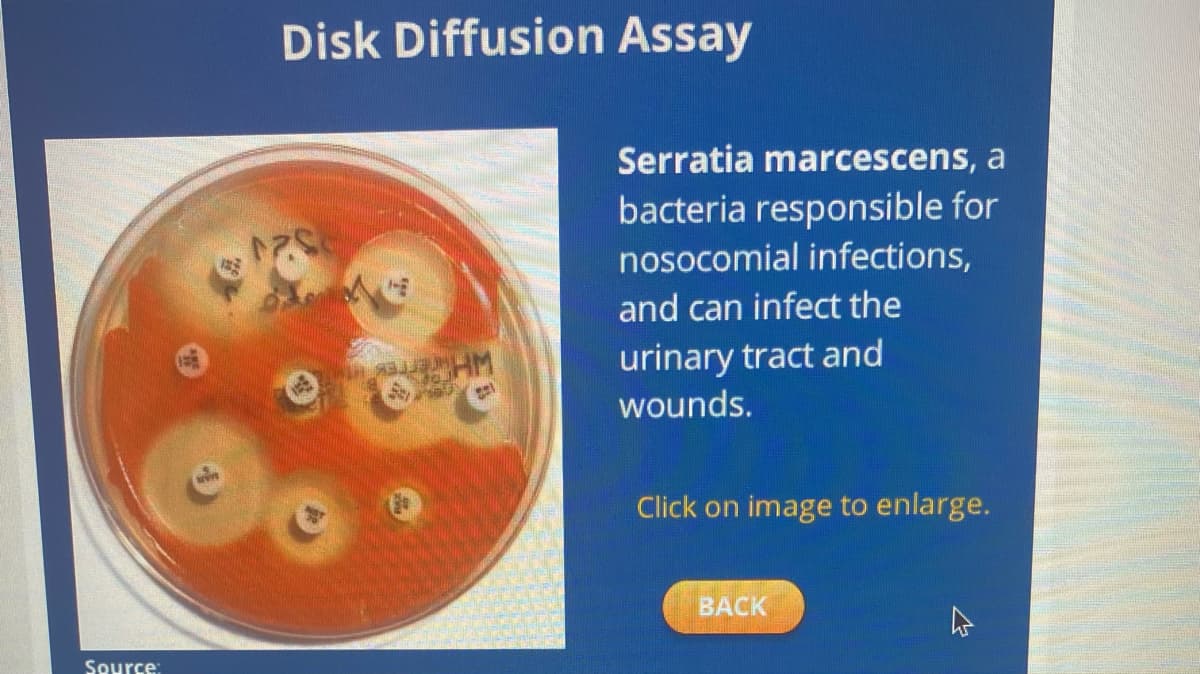 Source:
Disk Diffusion Assay
43.833UM
HM
1601
Serratia marcescens, a
bacteria responsible for
nosocomial infections,
and can infect the
urinary tract and
wounds.
Click on image to enlarge.
BACK