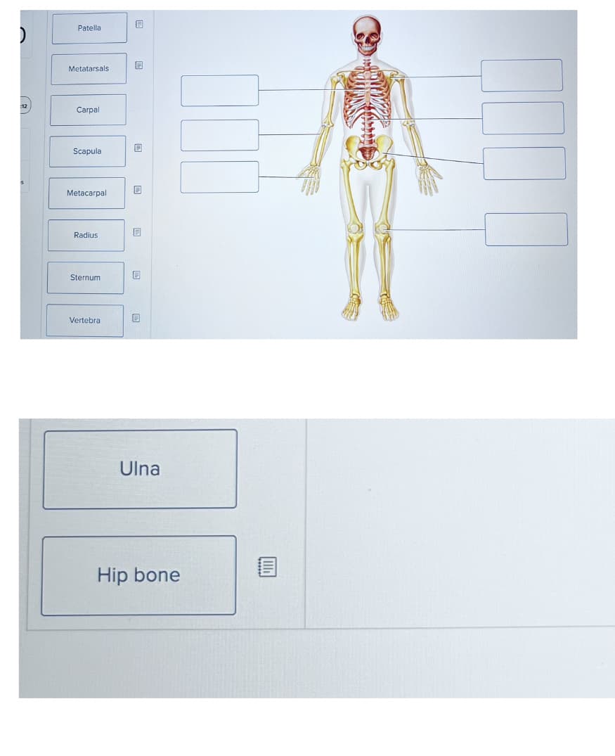 )
Patella
Metatarsals.
Carpal
Scapula
Metacarpal
Radius
Sternum
Vertebra
8
0
Ulna
Hip bone