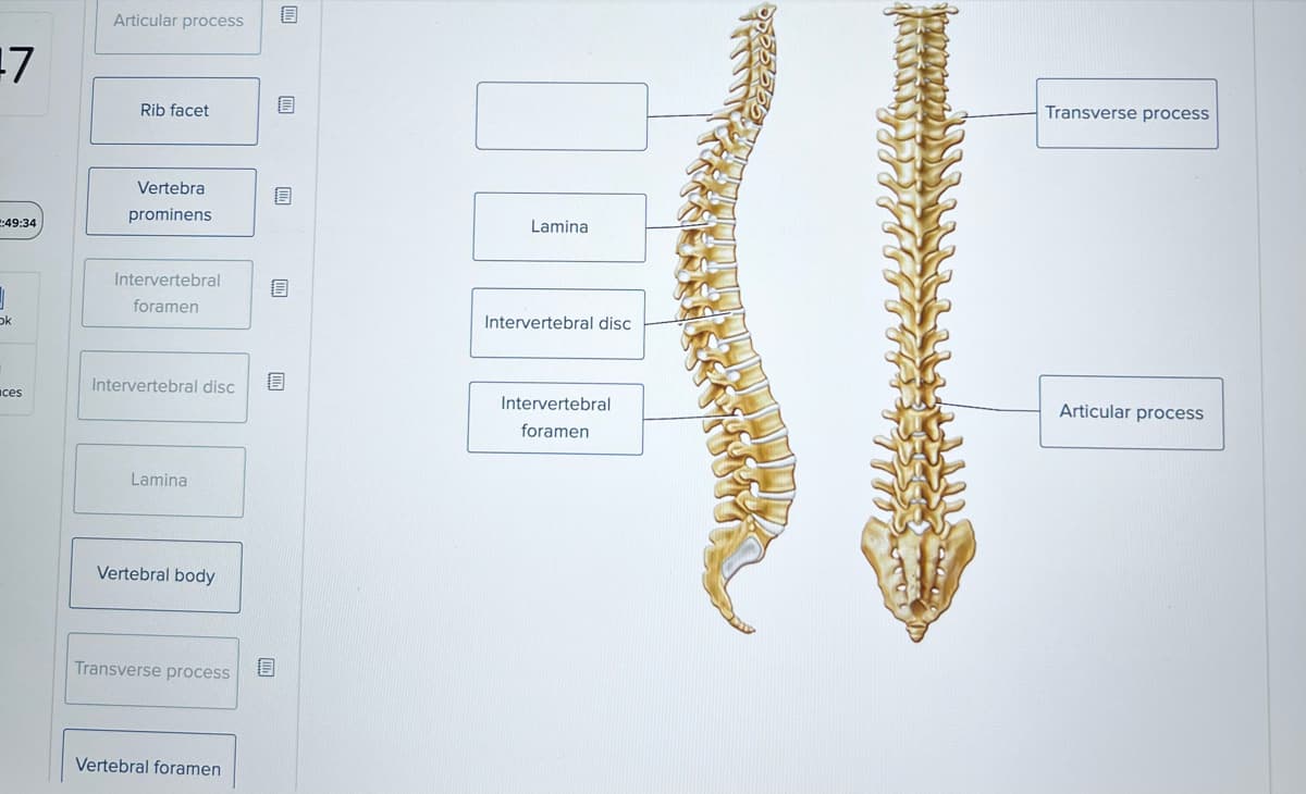 17
1:49:34
ok
ces
Articular process
Rib facet
Vertebra
prominens
Intervertebral
foramen
Intervertebral disc
Lamina
Vertebral body
Transverse process
Vertebral foramen
8
Illa
8
B
Lamina
Intervertebral disc
Intervertebral
foramen
Transverse process
Articular process